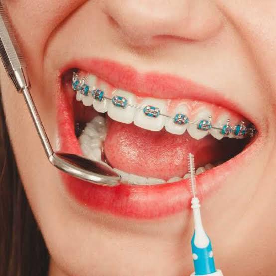 Orthodontist treatment