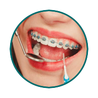 Orthodontist treatment